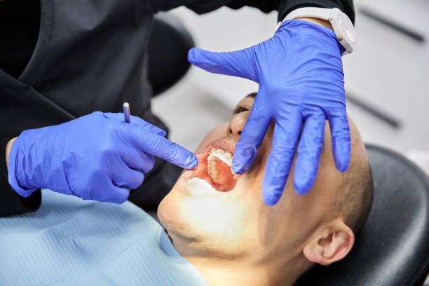 Best Cracked Tooth Emergency Dentist  in Wabasso, FL